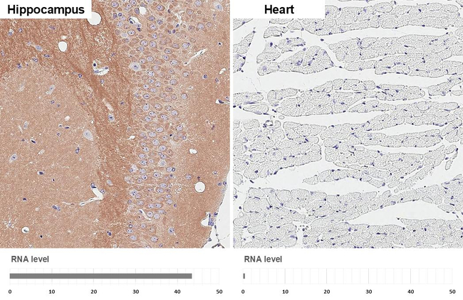 WAVE1 Antibody in Immunohistochemistry (Paraffin) (IHC (P))
