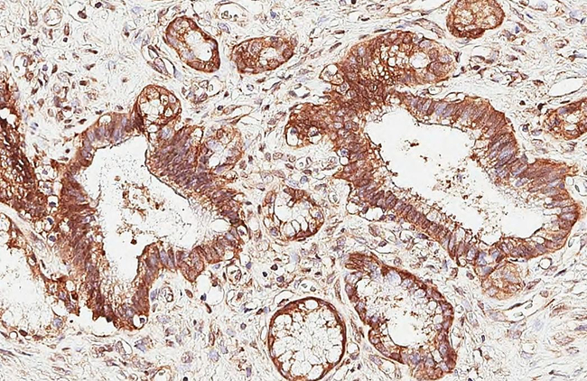 MROH2A Antibody in Immunohistochemistry (Paraffin) (IHC (P))