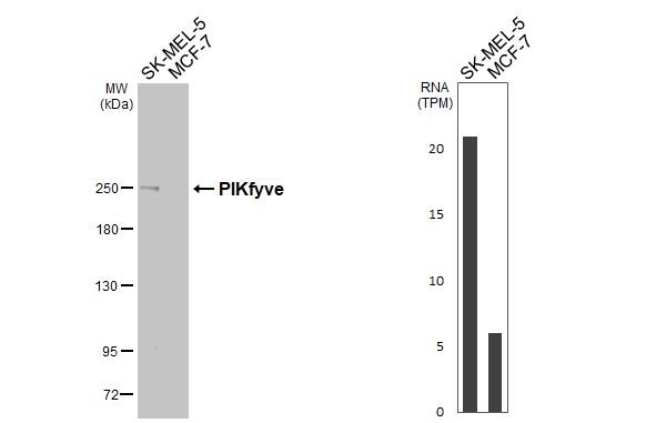 PIKFYVE Antibody in Western Blot (WB)