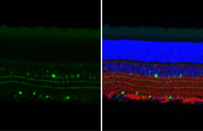 ChAT Antibody in Immunohistochemistry (Paraffin) (IHC (P))