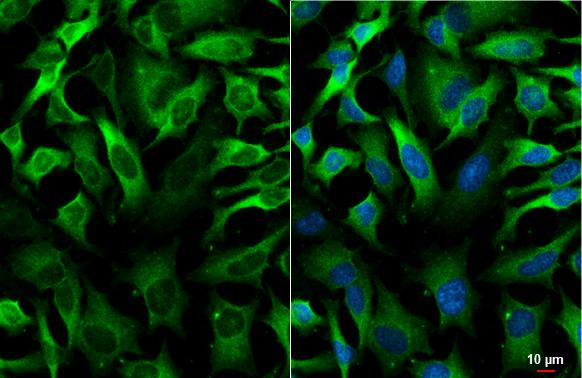 GEF-H1 Antibody in Immunocytochemistry (ICC/IF)