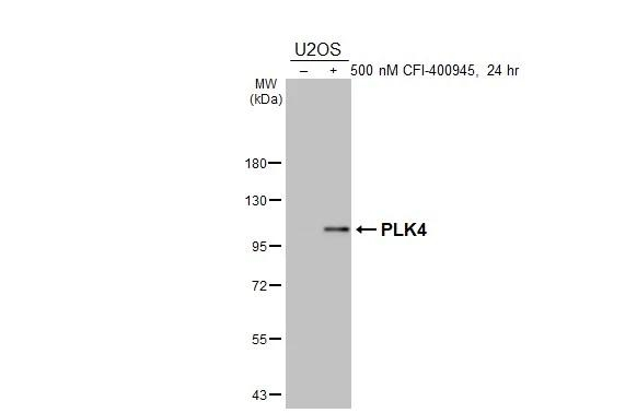 PLK4 Antibody in Western Blot (WB)