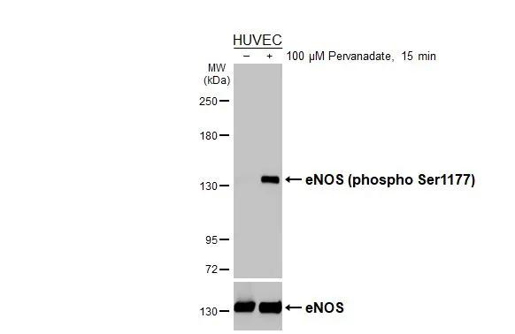 Phospho-eNOS (Ser1177) Antibody in Western Blot (WB)