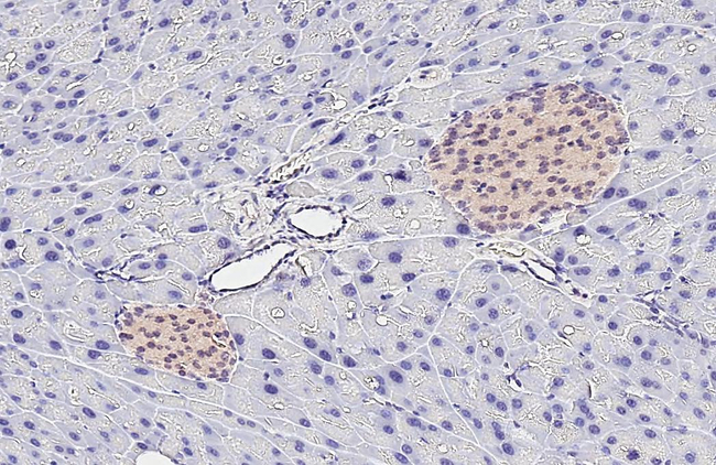 PLCG1 Antibody in Immunohistochemistry (Paraffin) (IHC (P))