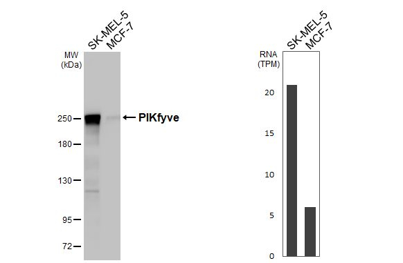 PIKFYVE Antibody in Western Blot (WB)