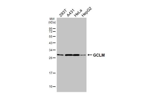 GCLM Antibody in Western Blot (WB)