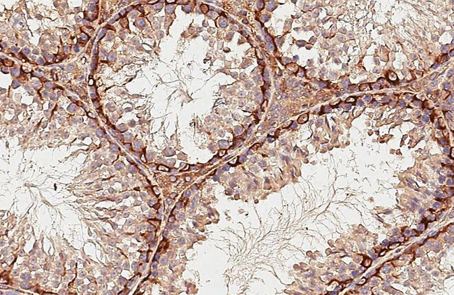 STX17 Antibody in Immunohistochemistry (Paraffin) (IHC (P))