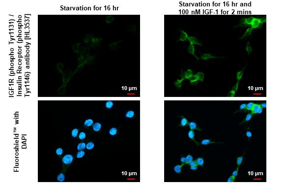 Phospho-IGF1R beta (Tyr1131, Tyr1146) Antibody in Immunocytochemistry (ICC/IF)