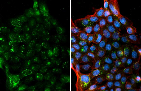 NMU Antibody in Immunocytochemistry (ICC/IF)
