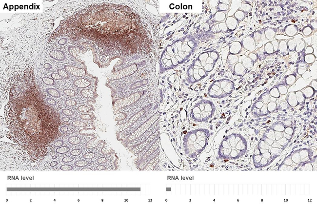 CXCR5 Antibody in Immunohistochemistry (Paraffin) (IHC (P))