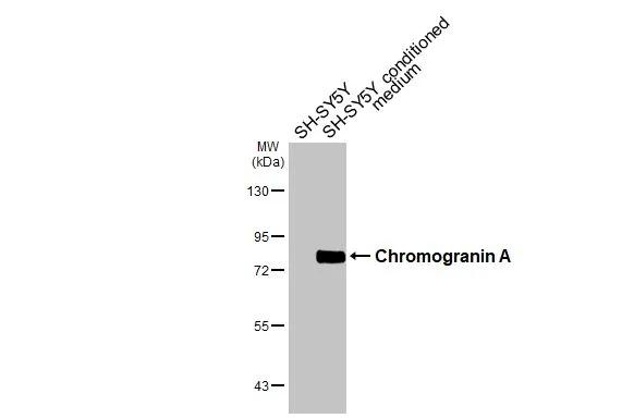 CHGA Antibody in Western Blot (WB)