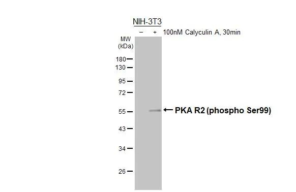 Phospho-PRKAR2A (Ser99) Antibody in Western Blot (WB)