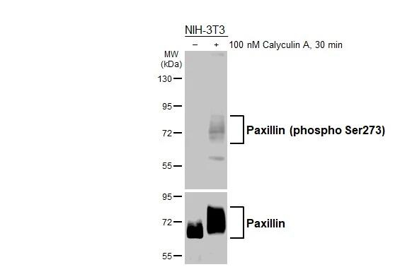 Phospho-Paxillin (Ser273) Antibody in Western Blot (WB)