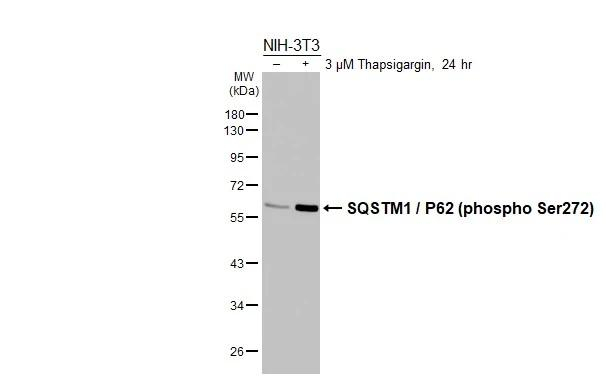 Phospho-SQSTM1 (Ser272) Antibody in Western Blot (WB)