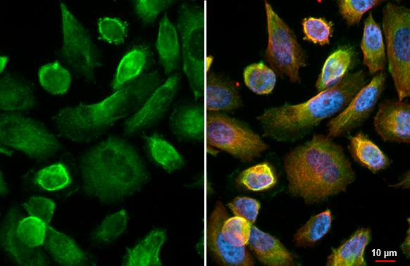 beta-2 Adrenergic Receptor Antibody in Immunocytochemistry (ICC/IF)