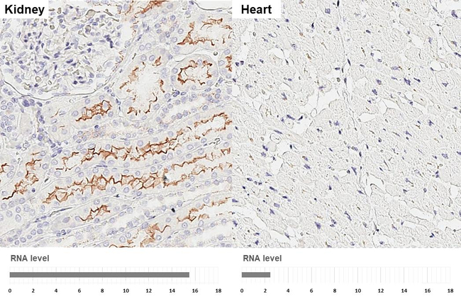 GPRC5C Antibody in Immunohistochemistry (Paraffin) (IHC (P))