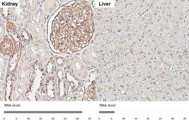 CD51 Antibody in Immunohistochemistry (Paraffin) (IHC (P))