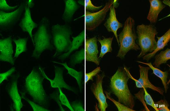 Cofilin Antibody in Immunocytochemistry (ICC/IF)