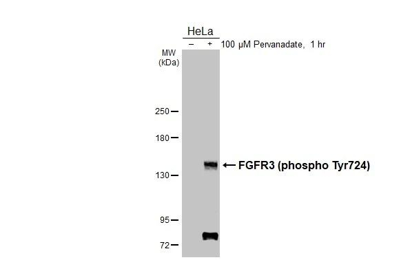 Phospho-FGFR3 (Tyr724) Antibody in Western Blot (WB)