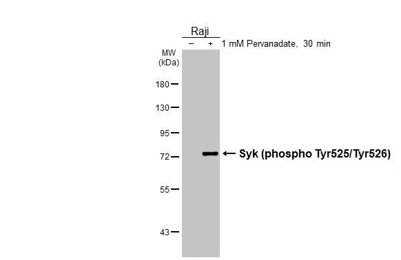 Phospho-Syk (Tyr525, Tyr526) Antibody in Western Blot (WB)