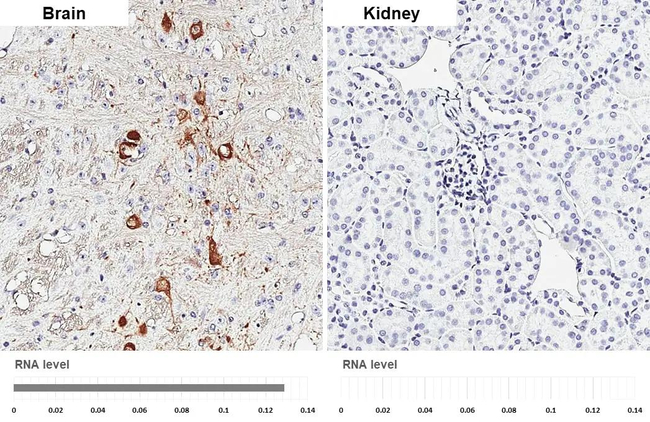 ChAT Antibody in Immunohistochemistry (Paraffin) (IHC (P))