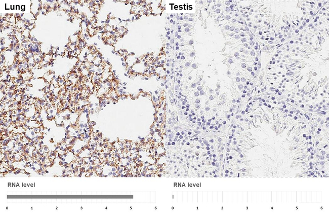 VPAC2 Antibody in Immunohistochemistry (Paraffin) (IHC (P))