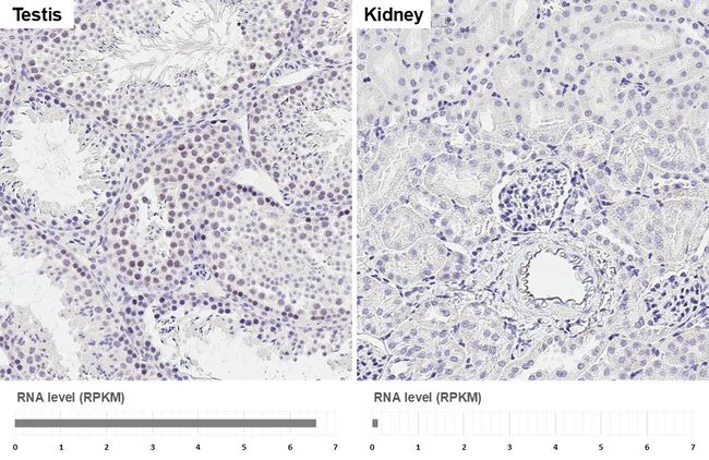 RAD51 Antibody in Immunohistochemistry (Paraffin) (IHC (P))