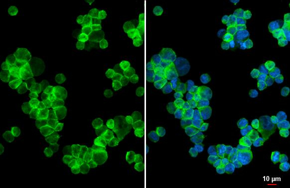 CD74 Antibody in Immunocytochemistry (ICC/IF)