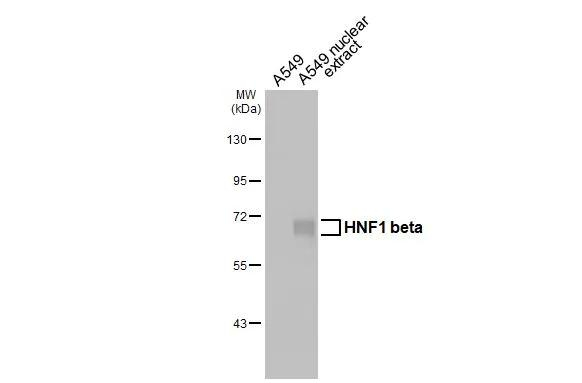 TCF2 Antibody in Western Blot (WB)