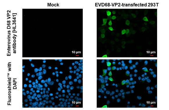 Enterovirus D68 VP2 Antibody in Immunocytochemistry (ICC/IF)