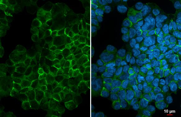 CCR5 Antibody in Immunocytochemistry (ICC/IF)