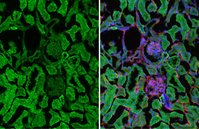 PTH1R Antibody in Immunohistochemistry (Frozen) (IHC (F))