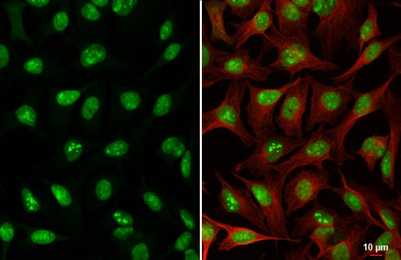 ADAR1 Antibody in Immunocytochemistry (ICC/IF)