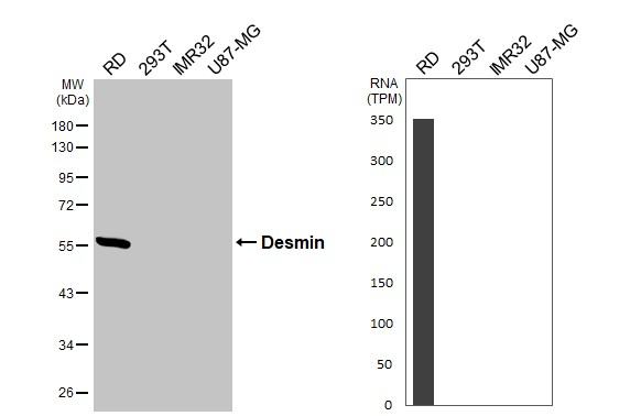 Desmin Antibody in Western Blot (WB)