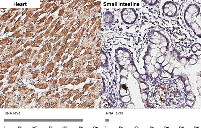 Desmin Antibody in Immunohistochemistry (Paraffin) (IHC (P))