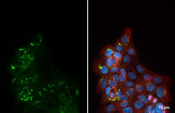 ORP8 Antibody in Immunocytochemistry (ICC/IF)
