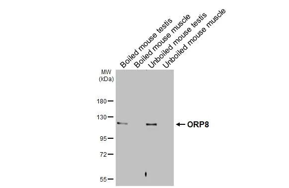 ORP8 Antibody in Western Blot (WB)