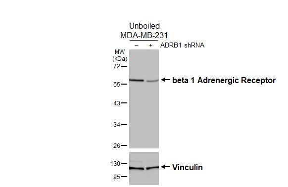 beta-1 Adrenergic Receptor Antibody in Western Blot (WB)