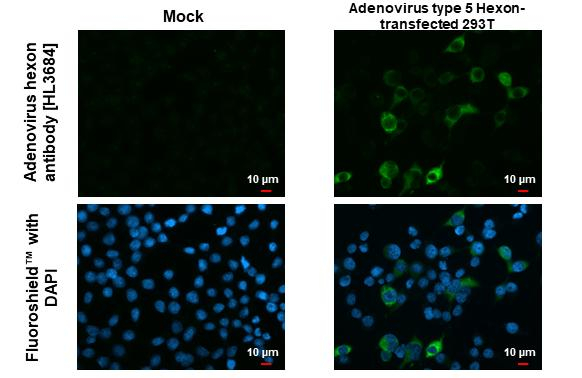 Adenovirus Hexon Antibody in Immunocytochemistry (ICC/IF)
