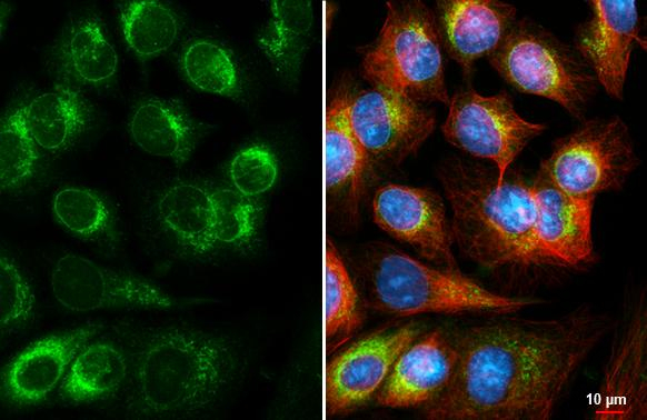 DHCR7 Antibody in Immunocytochemistry (ICC/IF)