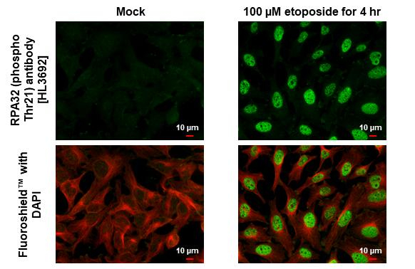 Phospho-RPA2 (Thr21) Antibody in Immunocytochemistry (ICC/IF)
