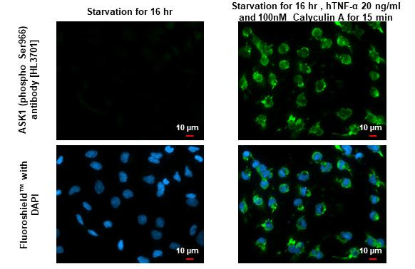 Phospho-ASK1 (Ser966) Antibody in Immunocytochemistry (ICC/IF)