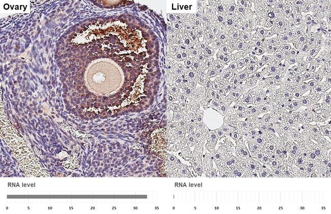 Thrombospondin 1 Antibody in Immunohistochemistry (Paraffin) (IHC (P))