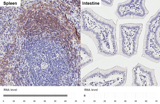 CXCR5 Antibody in Immunohistochemistry (Paraffin) (IHC (P))