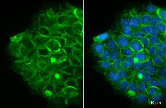 CD29 Antibody in Immunocytochemistry (ICC/IF)