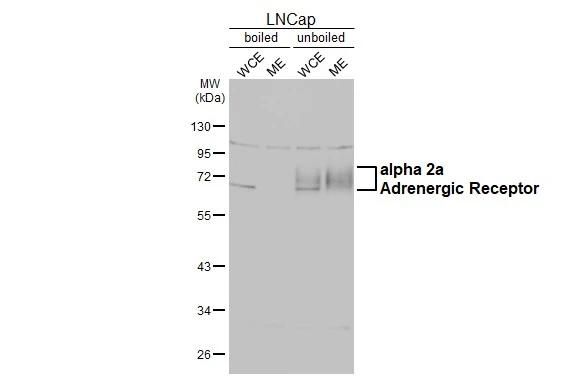 alpha-2a Adrenergic Receptor Antibody in Western Blot (WB)