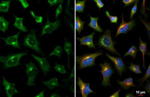 GALNT2 Antibody in Immunocytochemistry (ICC/IF)