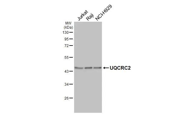 UQCRC2 Antibody in Western Blot (WB)