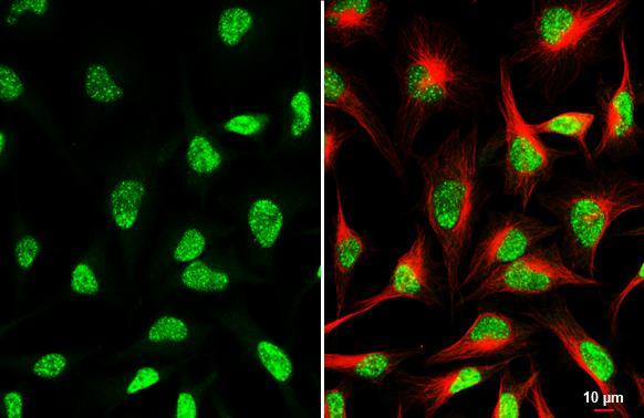 CDK12 Antibody in Immunocytochemistry (ICC/IF)