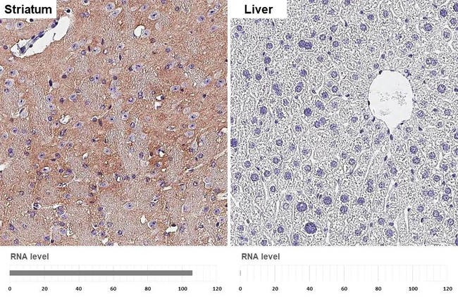 BASP1 Antibody in Immunohistochemistry (Paraffin) (IHC (P))